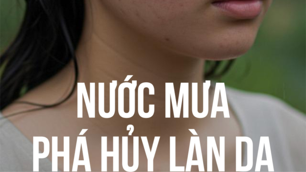 Bí Quyết Chăm Sóc Da Mụn Trong Những Ngày Mưa Ẩm Ướt Bí Quyết Chăm Sóc Da Mụn Trong Những Ngày Mưa Ẩm Ướt