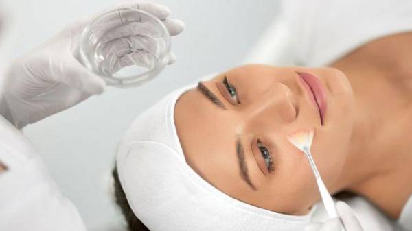 Peel da hóa học – Lựa chọn an toàn cho da mụn và da thường cần tái tạo