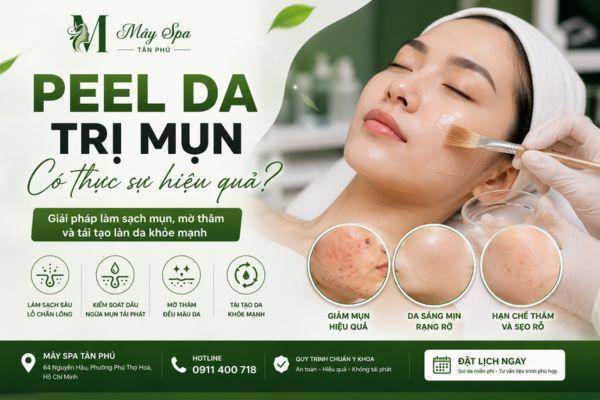 Peel Da Trị Mụn Có Thực Sự Hiệu Quả?