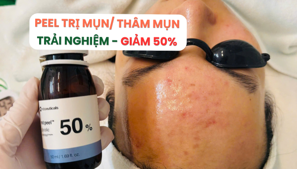 Trải Nghiệm Peel Mụn Y Khoa Giảm 50% Tại Mây Spa
