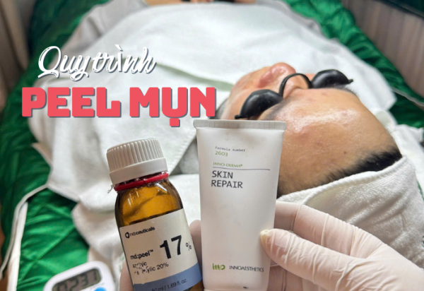 QUY TRÌNH PEEL MỤN TẠI SPA CHUYÊN NGHIỆP: GIẢI PHÁP AN TOÀN CHO LÀN DA MỤN