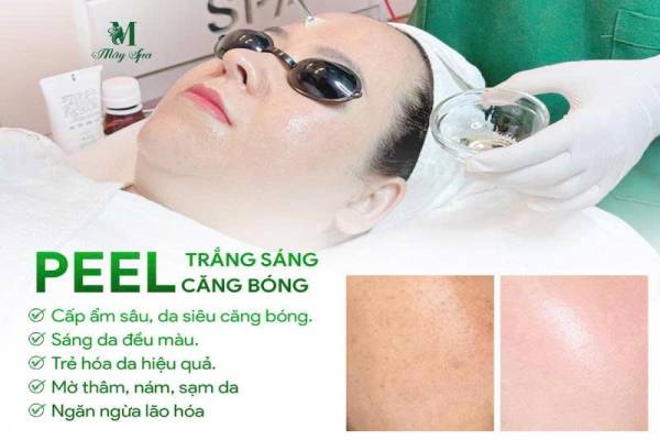 Spa Peel Da Uy Tín TP.HCM — Peel Da An Toàn, Hiệu Quả cho Mọi Vấn Đề Da