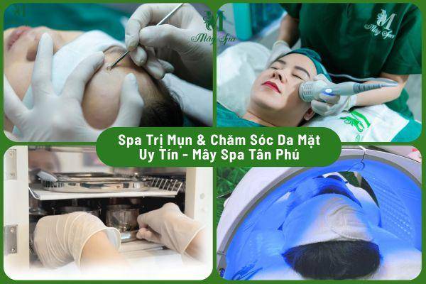 Spa trị mụn và chăm sóc da mặt uy tín tại Tân Phú – Mây Spa