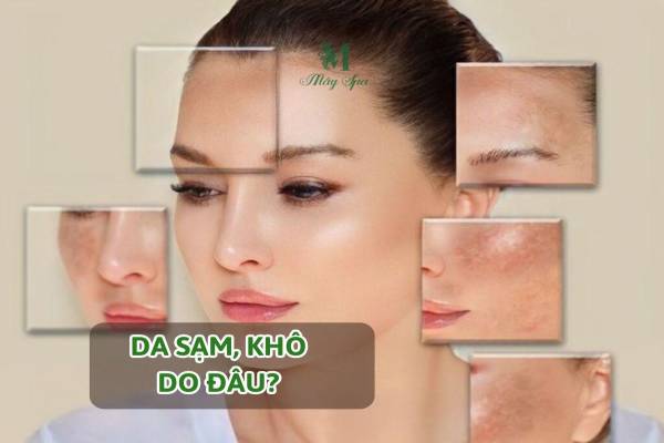 Tại sao da thường sạm và khô sau Tết? Góc nhìn khoa học từ chuyên gia Da liễu