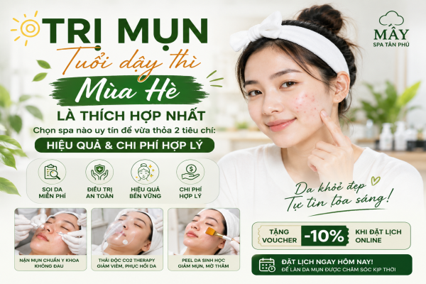 Trị Mụn Tuổi Dậy Thì Mùa Hè: Thời Điểm Vàng Để Cải Thiện Làn Da Và Chọn Spa Uy Tín
