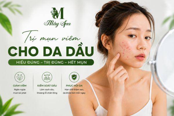 Trị Mụn Viêm Cho Da Dầu Hiệu Quả - Nguyên Nhân & Cách Điều Trị