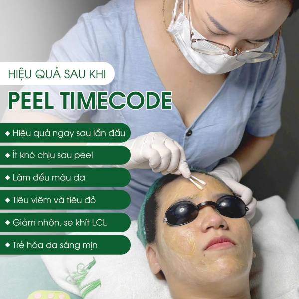 Vai Trò Của Chemical Peel Trong Quá Trình Trị Mụn