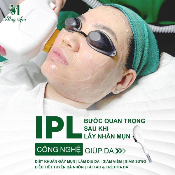 Vai trò của IPL trong việc trị mụn