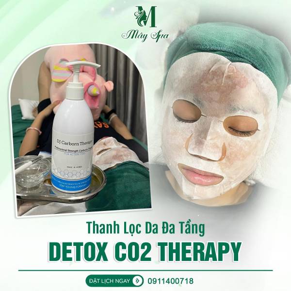 Combo Nặn Mụn + Thải Độc Da CO2 Therapy - Sạch Mụn, Thải Độc Da Combo Nặn Mụn + Thải Độc Da CO2 Therapy - Sạch Mụn, Thải Độc Da