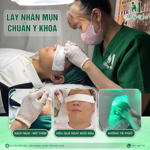 Lấy Nhân Mụn Chuyên Sâu Chuẩn Y Khoa - Không Để Lại Thâm, Sẹo Lấy Nhân Mụn Chuyên Sâu Chuẩn Y Khoa - Không Để Lại Thâm, Sẹo